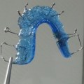 What is a $10,000 retainer?