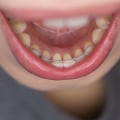 What does it mean if you are paid a retainer?